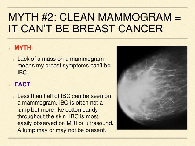 breast biopsy for inflamatory breast cancer Blonde teen pussy cumm
